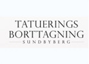 Tatueringsborttagning Sundbyberg